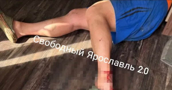 В СНТ под Ярославлем водительница проехала по стремянке с мужчиной